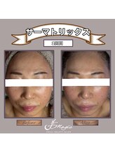 ビーマジック(美magic)/サーマトリックス