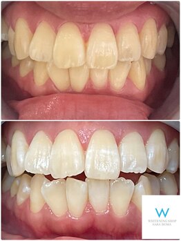 ホワイトニングショップ 奈良生駒店/メンテナンスでも！