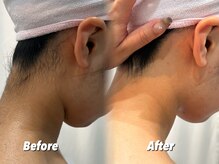 クイーン 渋谷店(QUEEN)/うなじケア