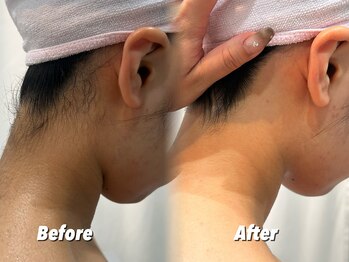 クイーン 渋谷店(QUEEN)/うなじケア