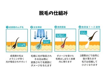 ビューティーソレイユ(BEAUTY SOLEIL)/脱毛の仕組み