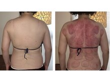 ウラヤス 恵比寿(Urayasu)/1回の効果です。