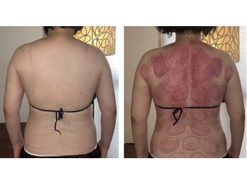 ウラヤス 恵比寿(Urayasu)/1回の効果です。