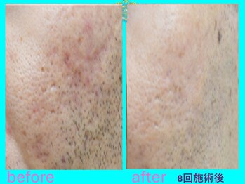 リュクス(LUXE)/ビフォーアフター