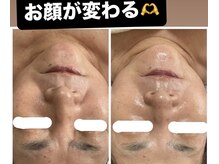 スズ(SUZU)の雰囲気(顔の印象が変わる*艶肌×毛穴×シミケア)