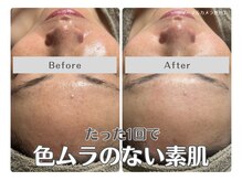 ルリアン(Lurian)/たった1回の変化！