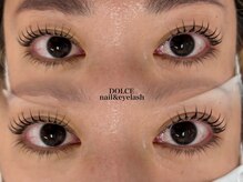 ドルチェ 久留米花畑店(Dolce)/まつ毛パーマ