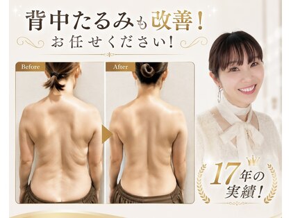 リコメンス(Recommence)の写真