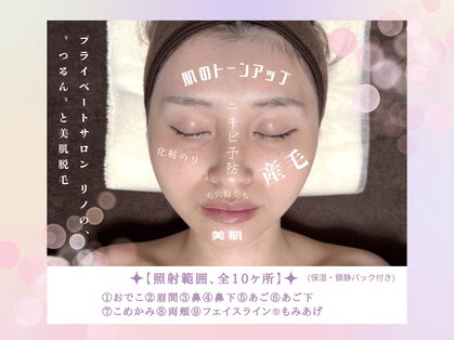 リノ(Lino)の写真