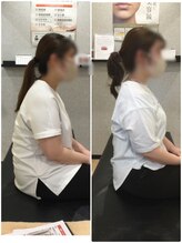 くすの樹接骨院 整体院 鳥栖院/整体/骨盤矯正ビフォーアフター