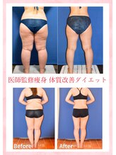 ピュアノア 垂水店 医師監修 痩身エステ