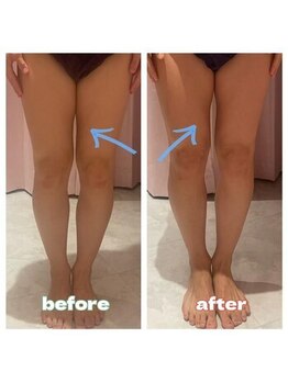 チル 渋谷店(CHILL)/ビフォアアフター