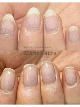 マリーロール 天王寺店(Marie Laure)/自爪育成/深爪矯正/ネイルケア
