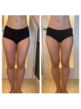 サロン ド オージャス(salon de ojas)/ビフォアフ脚