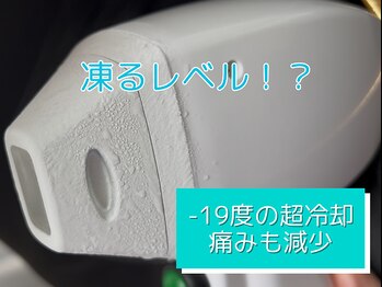 プラネット(Planet)/-19℃で痛み軽減