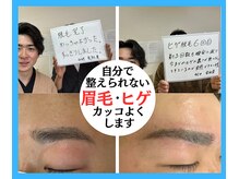 ビビ