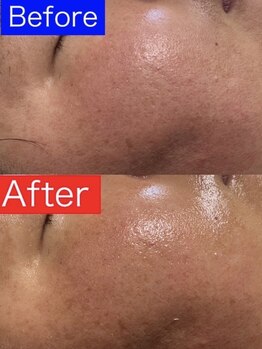 エナジーサロン アカリ(燿)/セルマン洗顔のみ