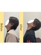 岡崎メディカル整体 アンド ゴールデンケア/つらい首・肩こり・頭痛（整体)
