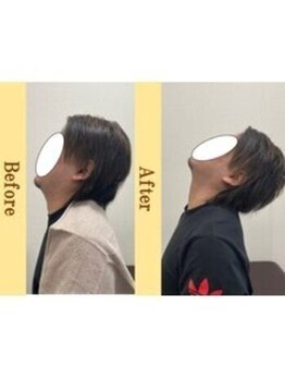 岡崎メディカル整体 アンド ゴールデンケア/つらい首・肩こり・頭痛（整体)