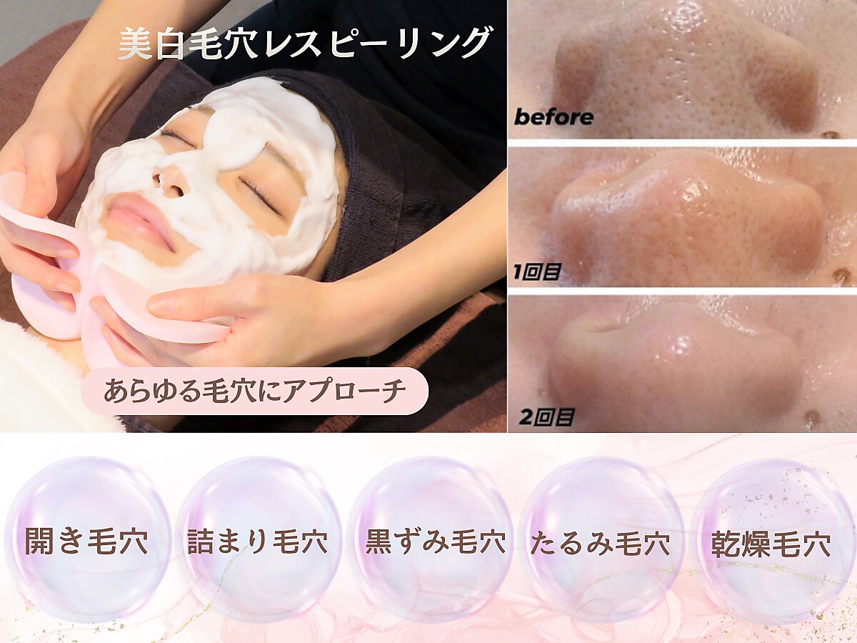 大通駅で毛穴ケアが人気のエステサロン｜ホットペッパービューティー