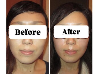 マンマ ジュンナ/【浜松/小顔/小顔矯正】