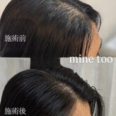 マイントゥー(mine too)