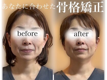 スピン(SPiN)の写真
