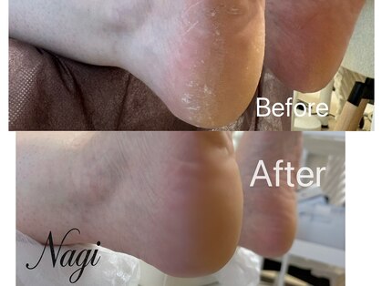 ナギネイル(Nagi Nail)の写真