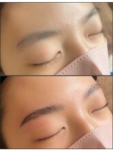 リヴェール/ハリウッドブロウリフト