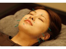 つぼぜん/【美容鍼で小顔】