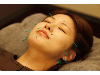 つぼぜん/【美容鍼で小顔】