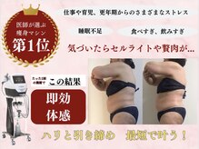 ミテ(Mite)の雰囲気（香椎宮前駅から徒歩3分！本気痩せしたい方！写真は施術1回の結果）