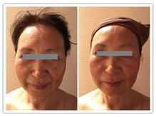 アユナタ(Ayu Natah)/60代のお客様たるみ予防に