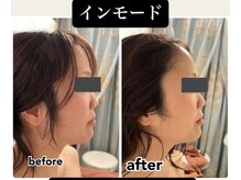 ミューズ よもぎ蒸し(MUSE)/◆インモード◆