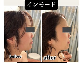 ミューズ よもぎ蒸し(MUSE)/◆インモード◆