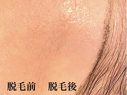 アマト 心斎橋店(Amato)の写真