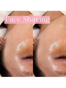 リンド エステ まつげ 京成大久保(Lind)/フェイスシェービング