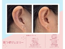 丸太町骨盤整骨院 鍼灸院/耳つぼジュエリー