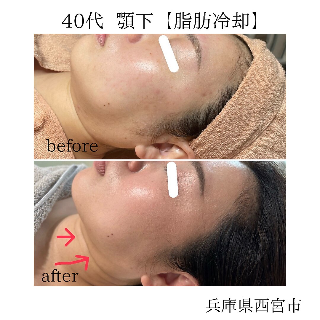 ルーチェエムベルシック(Luce.MBelChic)｜ホットペッパービューティー