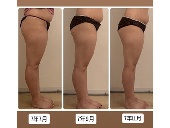 フランベル(Franc bell)/パイラソード【足モニター】