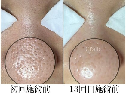 シエール 調布(Ci'aile)の写真