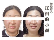 ベラ 東京院(Bella)の雰囲気（骨格や筋肉の左右差をみて根本改善【小顔/肌質改善/西東京】）