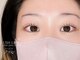 アチャ(accha)の写真