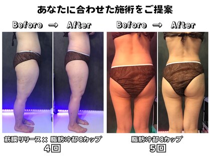 サニー(SUNNIE)の写真