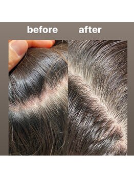 シュール センター南(SURREAL)/ヘッドスパ後のビフォーアフター