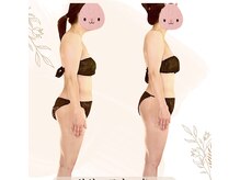 ラクア/リリースカッター施術1回の効果