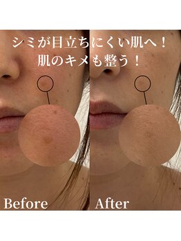 ザモア 福岡天神(THE MORE)/ホワイトシャイン【全身美白】