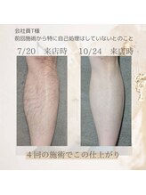 アールブイ 館林店(RV)/足脱毛