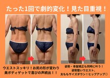 ヨサパーク セルヴィ(YOSA PARK セル美)