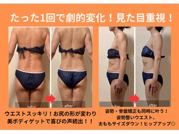 ヨサパーク セルヴィ(YOSA PARK セル美)